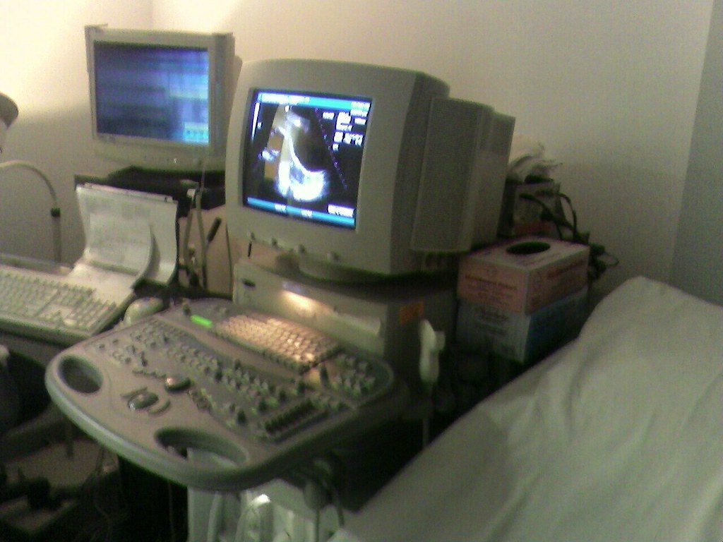 UltraSound